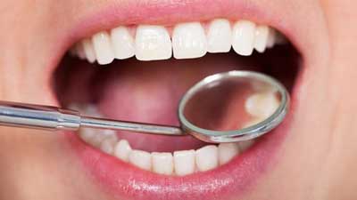 چند روش طبیعی برای خلاصی از جرم دندان