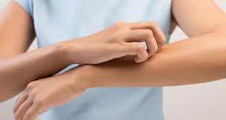 آلرژی پوستی چیست و چگونه درمان می‌شود؟