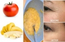 رفع چین و چروک صورت فقط در 3 روز رفع چین و چروک صورت فقط در 3 روز