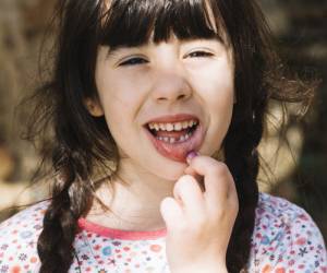 جدی و مهم در مورد دندان شیری کودکتان