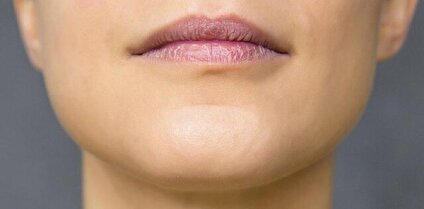 چرا فقط انسان‌ها چانه دارند؟