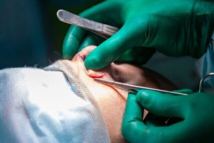 چرا شیادها در بازار جراحی زیبایی کاسبی شان پررونق است؟